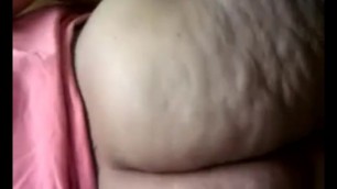 Fat Cellulite Butt
