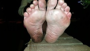 Mature Lady 0ff the Streets Shows 0ff her Dirty Feet - really Bad